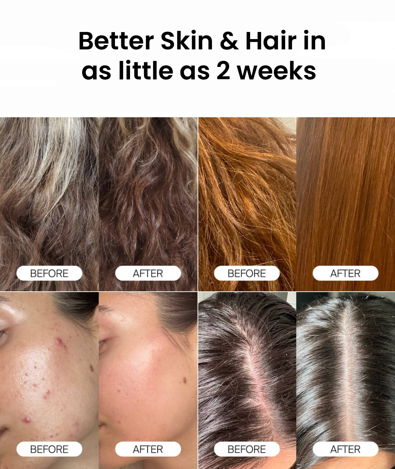 PureFlow® Clinical Shower Filter