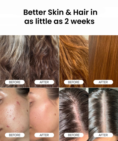 PureFlow® Clinical Shower Filter